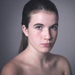 Beauty dish